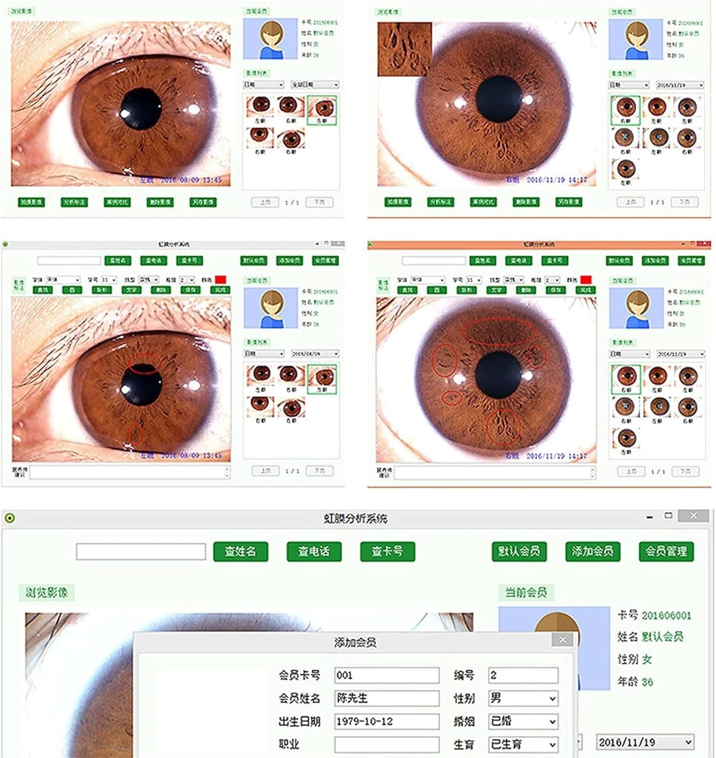 New 5.0MP USB Iriscope Iris Analyzer Iridology Camera with Iris English Software